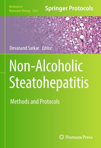 Non-Alcoholic Steatohepatitis: Methods and Protocols (Methods in Molecular Biology, 2455) (PDF/EPUB Version)