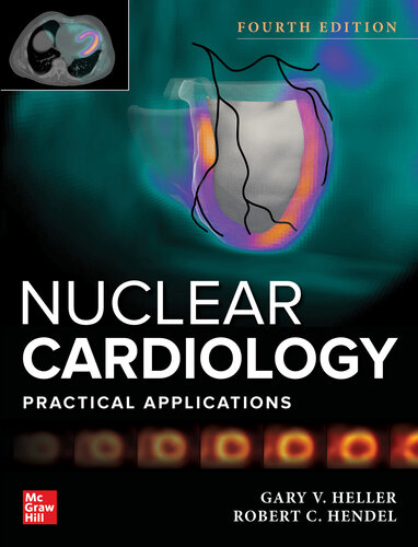 Nuclear Cardiology: Practical Applications (PDF/EPUB Version)