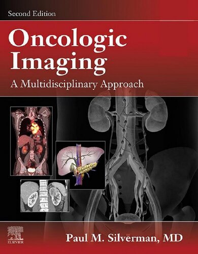 Oncologic Imaging: A Multidisciplinary Approach: Expert Consult - Online and Print (PDF/EPUB Version)