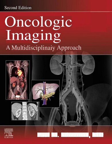 Oncologic Imaging: A Multidisciplinary Approach (PDF/EPUB Version)