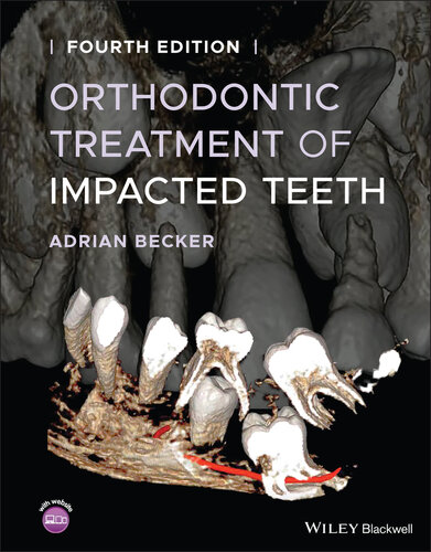 Orthodontic Treatment of Impacted Teeth (PDF/EPUB Version)