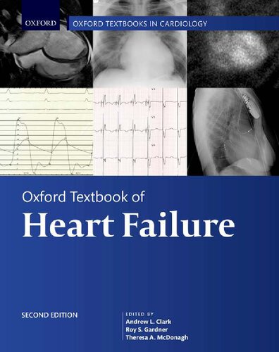 Oxford Textbook of Heart Failure (Oxford Textbooks in Cardiology) [Team-IRA] (True PDF_ (PDF/EPUB Version)