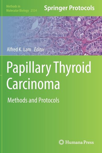 Papillary Thyroid Carcinoma: Methods and Protocols (Methods in Molecular Biology, 2534) (PDF/EPUB Version)