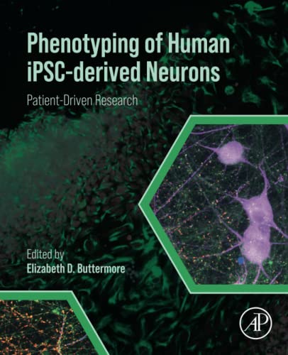 Phenotyping of Human iPSC-derived Neurons: Patient-Driven Research (PDF/EPUB Version)