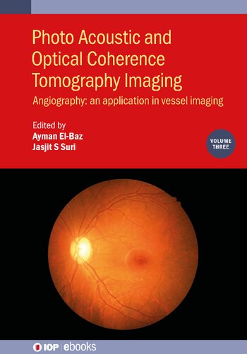 Photo Acoustic and Optical Coherence Tomography Imaging: Angiography: - An Application in Vessel Imaging (PDF/EPUB Version)