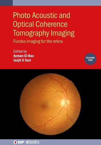 Photo Acoustic and Optical Coherence Tomography Imaging, Volume 2: Fundus Imaging for the Retina (PDF/EPUB Version)