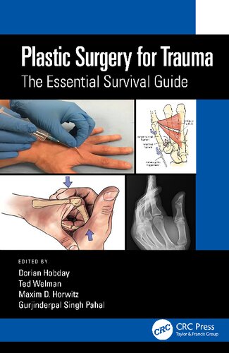 Plastic Surgery for Trauma: The Essential Survival Guide (PDF/EPUB Version)