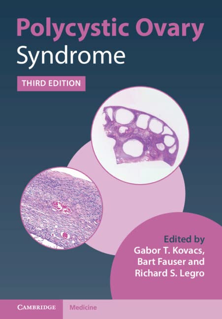 Polycystic Ovary Syndrome (PDF/EPUB Version)