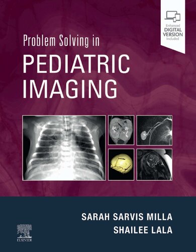 Problem Solving in Pediatric Imaging, 1e (PDF/EPUB Version)