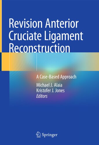 Revision Anterior Cruciate Ligament Reconstruction: A Case-Based Approach (PDF/EPUB Version)
