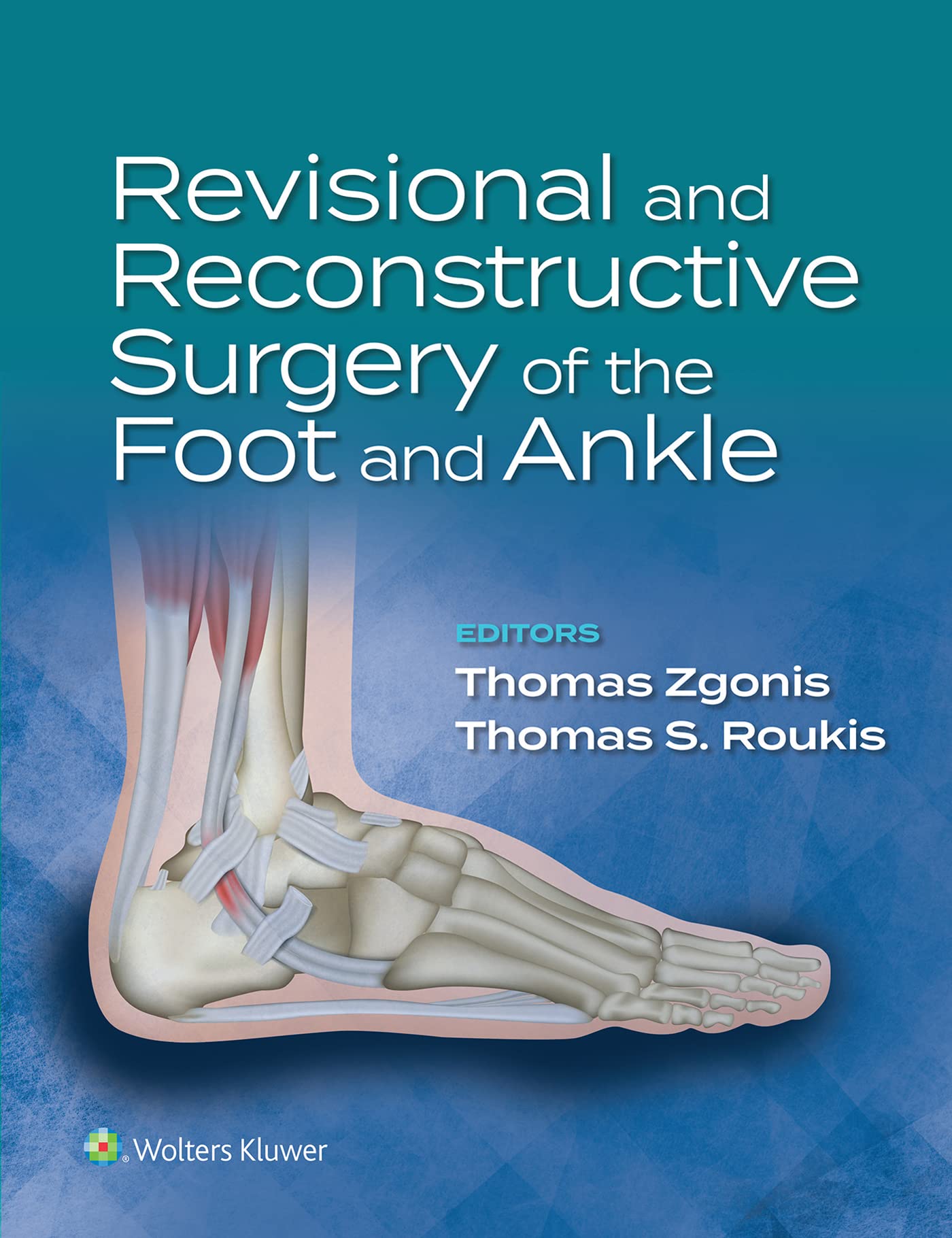 Revisional and Reconstructive Surgery of the Foot and Ankle (PDF/EPUB Version)