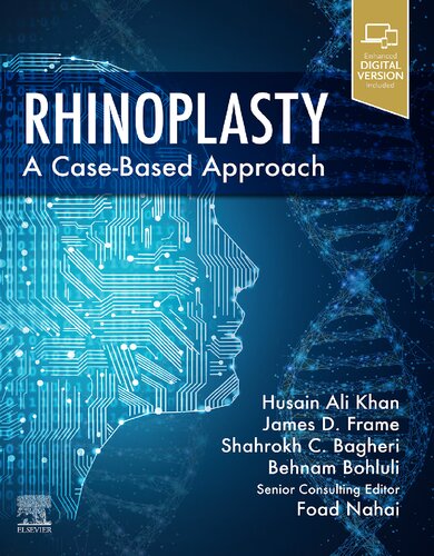 Rhinoplasty: A Case-Based Approach (PDF/EPUB Version)
