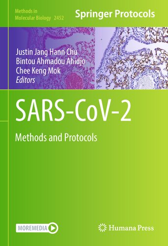 SARS-CoV-2: Methods and Protocols (Methods in Molecular Biology, 2452) (PDF/EPUB Version)