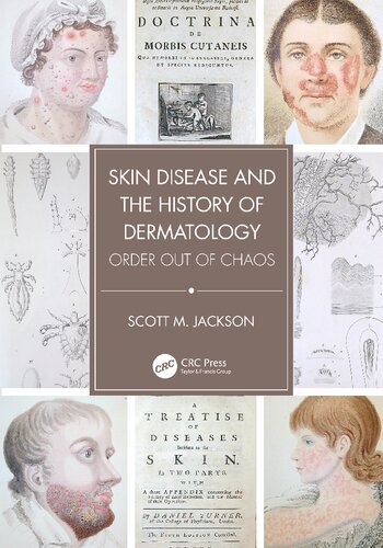 Skin Disease and the History of Dermatology: Order out of Chaos (PDF/EPUB Version)