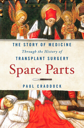 Spare Parts: The Story of Medicine Through the History of Transplant Surgery (PDF/EPUB Version)
