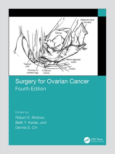 Surgery for Ovarian Cancer (PDF/EPUB Version)