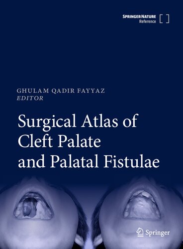 Surgical Atlas of Cleft Palate and Palatal Fistulae (PDF/EPUB Version)