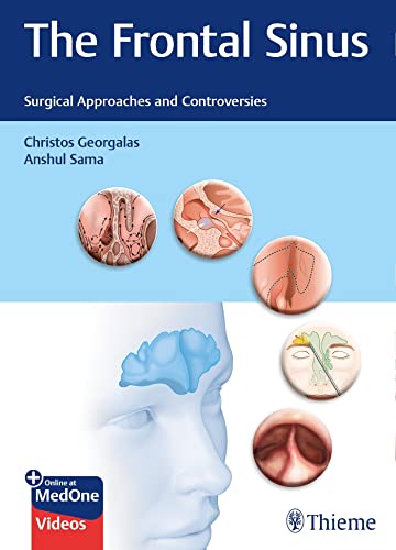 The Frontal Sinus: Surgical Approaches and Controversies (PDF/EPUB Version)