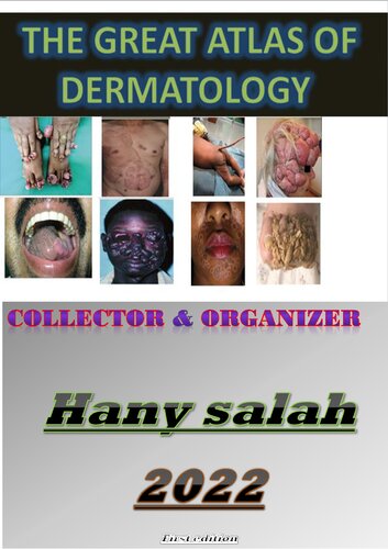 THE GREAT ATLAS OF DERMATOLOGY - Edit Book (PDF/EPUB Version)