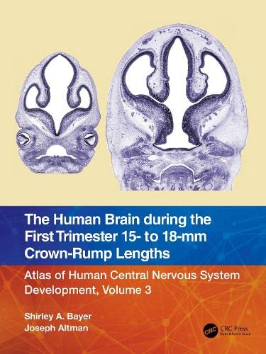 The Human Brain during the First Trimester 15- to 18-mm Crown-Rump Lengths (PDF/EPUB Version)