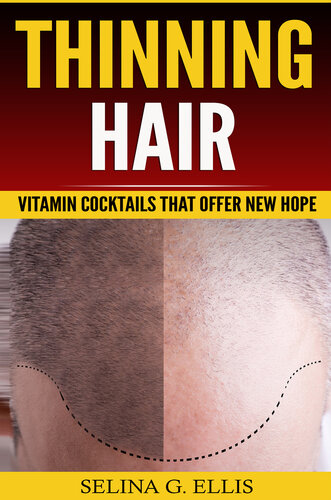 Thinning Hair: Vitamin Cocktails That Offer New Hope (PDF/EPUB Version)