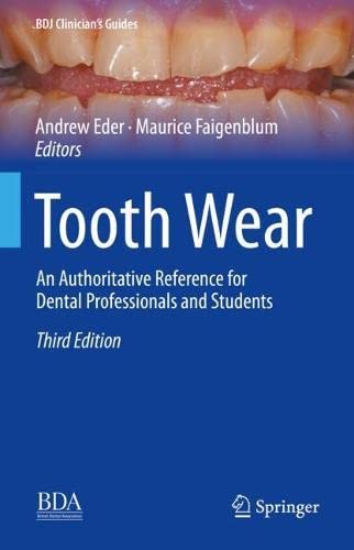 Tooth Wear: An Authoritative Reference for Dental Professionals and Students (BDJ Clinician’s Guides) (PDF/EPUB Version)
