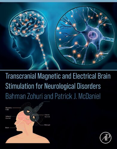 Transcranial Magnetic and Electrical Brain Stimulation for Neurological Disorders (PDF/EPUB Version)