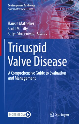 Tricuspid Valve Disease: A Comprehensive Guide to Evaluation and Management (Contemporary Cardiology) (PDF/EPUB Version)