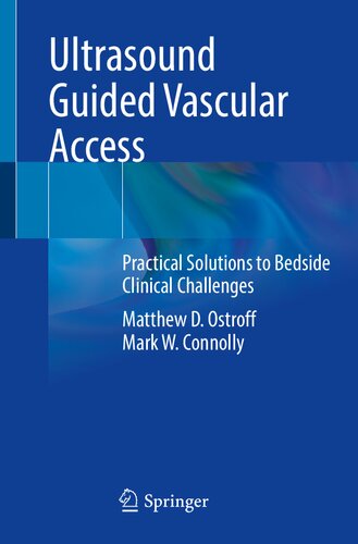 Ultrasound Guided Vascular Access: Practical Solutions to Bedside Clinical Challenges (PDF/EPUB Version)