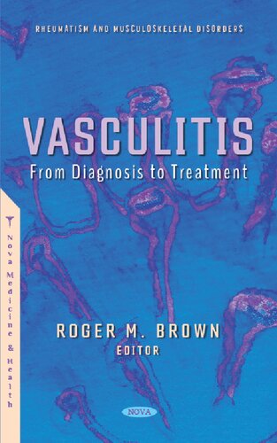 Vasculitis: From Diagnosis to Treatment (PDF/EPUB Version)