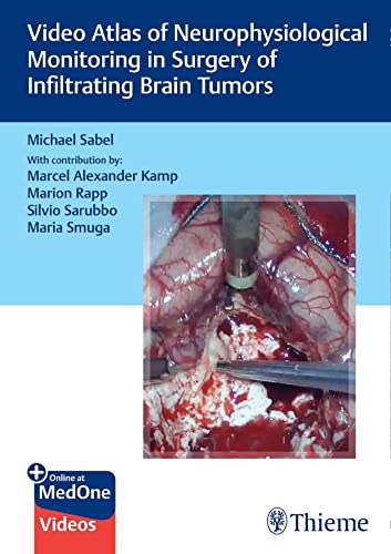 Video Atlas of Neurophysiological Monitoring in Surgery of Infiltrating Brain Tumors (PDF/EPUB Version)
