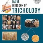 IADVL Textbook of Trichology